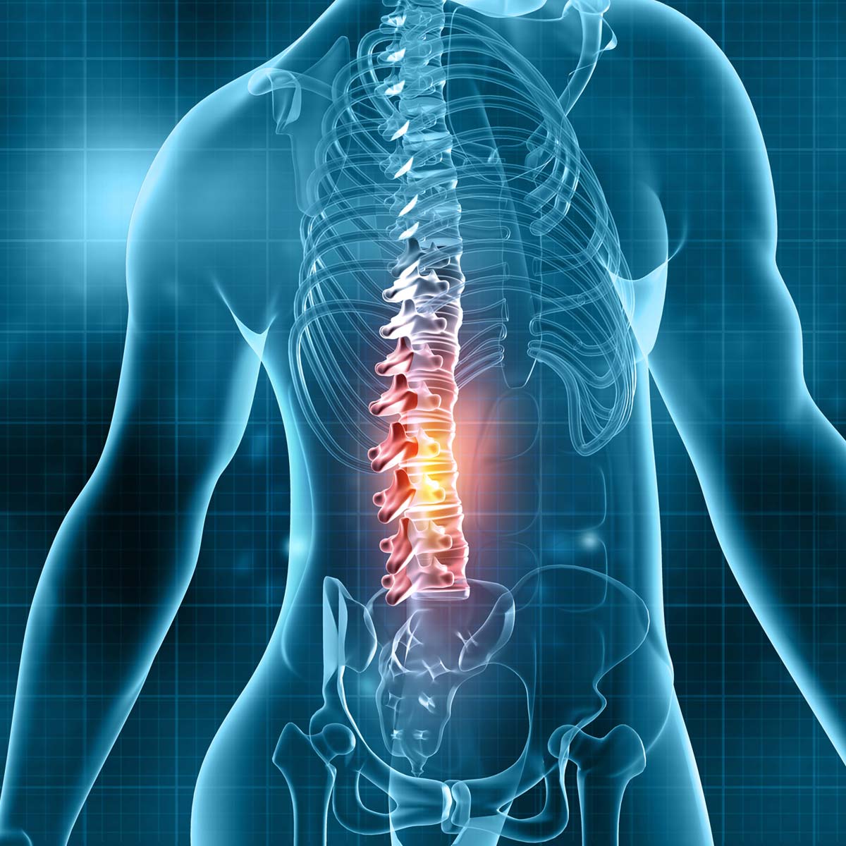 X-ray illustration of spine